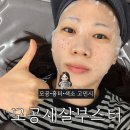 주의집중 | 대구모공관리｜통증이 비교적 적었던 [모공새살부스터] 나비존 집중 시술 당일 후기