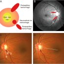 RR-88[천진암로]-하-61 | 임종평 2020.11
