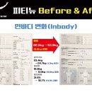 비포에프터 이미지
