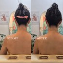 예뻐졌다 동의대역점 | [부산 승모근 관리] 예뻐졌다 동의대역점, 목&승모근 케어 후기