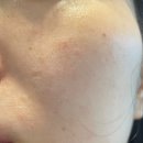 오룸스킨 이미지