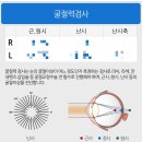 밝은빛안과의원 | [ 강남 안과 ] 밝은성모안과의원 강남 검사 후기 #내돈내산