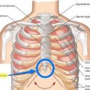 검상돌기, 명치아래통증 괜찮을까? 이미지