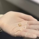 상주치과기공소 이미지