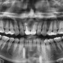 찬스플란트치과의원 이미지