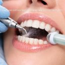 안치과 | 파주 문산 올바로치과🦷 스케일링 후기 (생각보다 안 아팠어요)