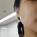 모공관리부터 속광까지 한 번에, 노워터 브이에쉬 글로우 더마랩 필오프팩 후기