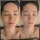 화정 피부관리 신혜원 에스테틱 앤 헤드스파 화정점 만족후기