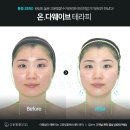 세븐일레븐 마장고운타워점 | 창원 얼굴관리 리프팅 최강자_온다온다