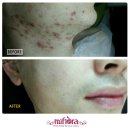 제트슬림체형피부관리실 이미지