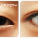 리코성형외과의원 이미지