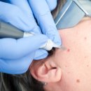 벨아미-리노보의원 이미지