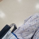 수면부상 | 배드민턴 부상 대퇴부 경부 골절 수술후기