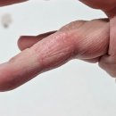풀내음자연약초 | 아토피 가려움 피부 장벽 회복위해 아토5분 발라요