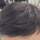김호증모가발대구체인헤어슈 | 대구남자가발잘하는곳 김호증모가발 대구 체인 헤어슈 만족후기예용^^