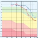 이경원보청기 | [보청기착용 후기] 1. 난청의 발생과 보청기 첫 착용