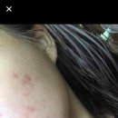 오투에스 이미지