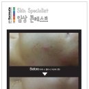 예림스킨케어