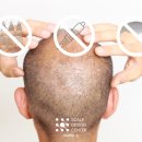 스칼프디자인센터 광주점 이미지