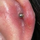 신호 | 귓바퀴 염증 초기 신호, 살튀 직전 관리 + 3주 후기