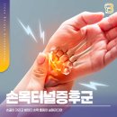 지산바른정형외과의원 | 지산역 범물역 정형외과 손끝 저림과 밤마다 심해지는 손목 통증, 원인은?