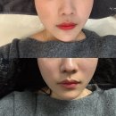 신용동 | 첨단2지구 | 신용동 탄력 윤곽관리 리프팅 후기 “유뷰티”