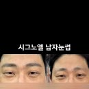 시그노엘 네이버블로그