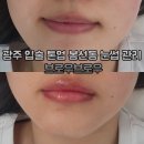 무등약국 | 광주 입술 톤업 봉선동 눈썹 관리 브로우브로우