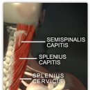 splenius capitis, splenius cervsi, semispinalis capitis muscles 이미지