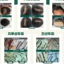 도노포레스타 이미지