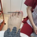 나도손톱 레푸스 개봉점 이미지