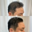 일산두피&눈썹단미토탈뷰티