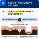 연골 이미지