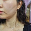 아셀 - 안양시 동안구 평촌대로374번길 9-7 | [잠실 피부과] 쥬브아셀 스킨 부스터 솔직 후기