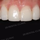 메인치과기공소 이미지