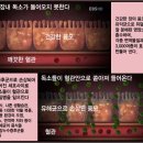 강동구 다이어트 맑음한의원 - 장누수증후군 예방을위한 듀오락 IBS (아이비에스), 굽은다리, 홈플러스