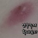 의료화장품 | 인천 주안 뾰루지 피부과 내돈내산 솔직 후기 및 진료비