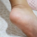 닥터씨 네이버블로그
