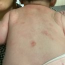 수앤은의원 | [앱솔루트 HA 분유, 아토팜 MLE 크림, 제로이드 포밍클렌저, 에스트라 아토베리어 포밍크렌저 바디워시...