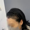 S헤어라인