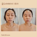 골드스킨&바디 이미지