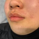 아나덴슈가링왁싱 대구상인점 이미지