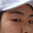 미앤필의원 네이버블로그