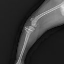 (주)라온메디칼 이미지