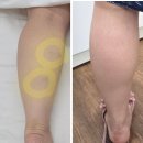 금정미용샵 | 금정구에스테틱 뷰티인스킨 부종관리 잘하는 곳 | 아로마 하체 수기관리 :: 종아리 붓기관리 후기