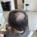 Stylish.M & 임명수헤어 | 서면탈모펌 정수리가 휑하다면 꼭 해야되는 펌 추천