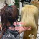 분당-207 | 깜짝 놀랄 비포&amp;애프터! 흑발에서 눈부신 백금발로, 분당 블랙빼기 시술 후기