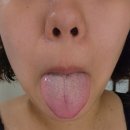 샬롬약국 | 백태제거기 브리올 혀클리너 추천