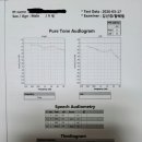 PTA검사의 Reliability(신뢰성)-poor와 보청기구입문의 이미지