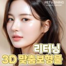 맞춤보형물 3d코성형 내돈내산코후기 리터닝성형외과에서✨